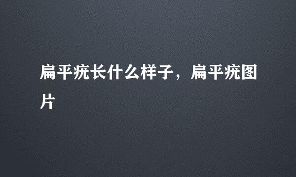 扁平疣长什么样子，扁平疣图片