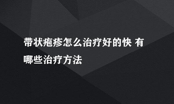 带状疱疹怎么治疗好的快 有哪些治疗方法