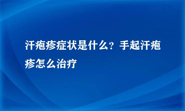 汗疱疹症状是什么？手起汗疱疹怎么治疗