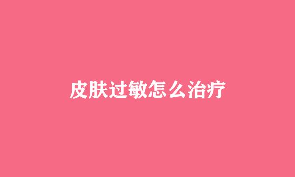 皮肤过敏怎么治疗