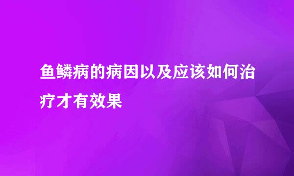 鱼鳞病的病因以及应该如何治疗才有效果