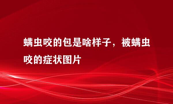 螨虫咬的包是啥样子，被螨虫咬的症状图片